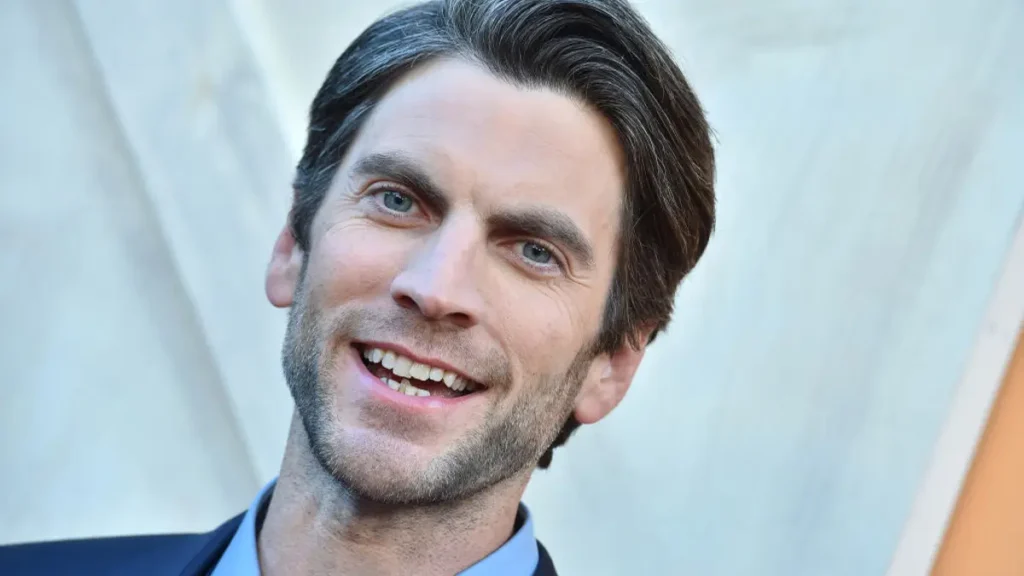 Wes Bentley Teeth